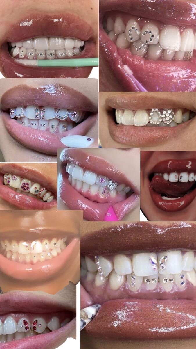 Tooth  gems