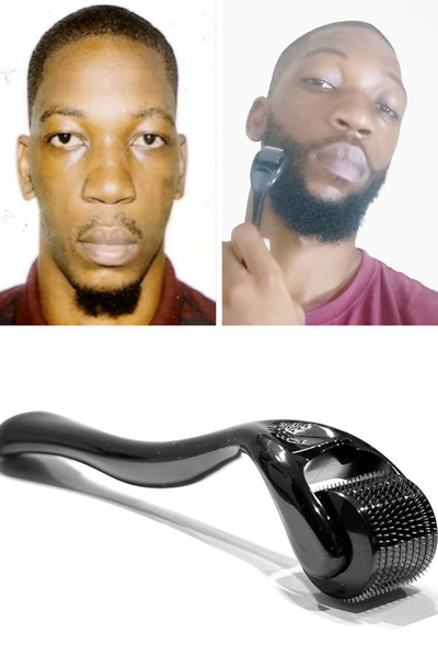 Solution rapide barbe uniforme