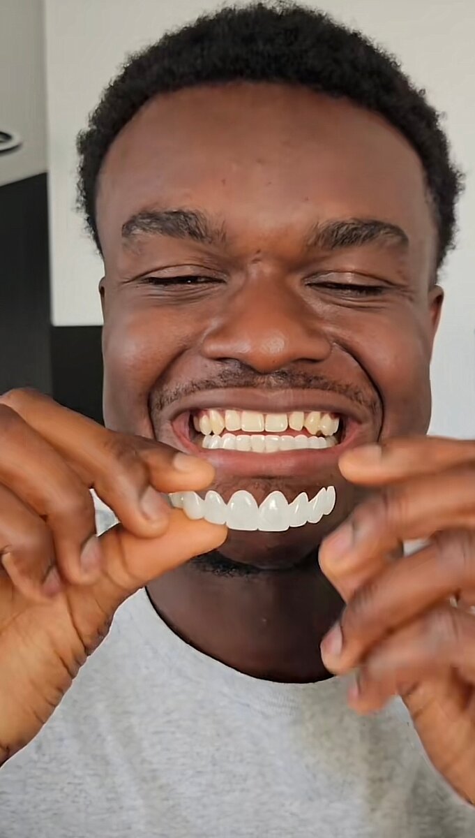 Facette dentaire joli  sourire