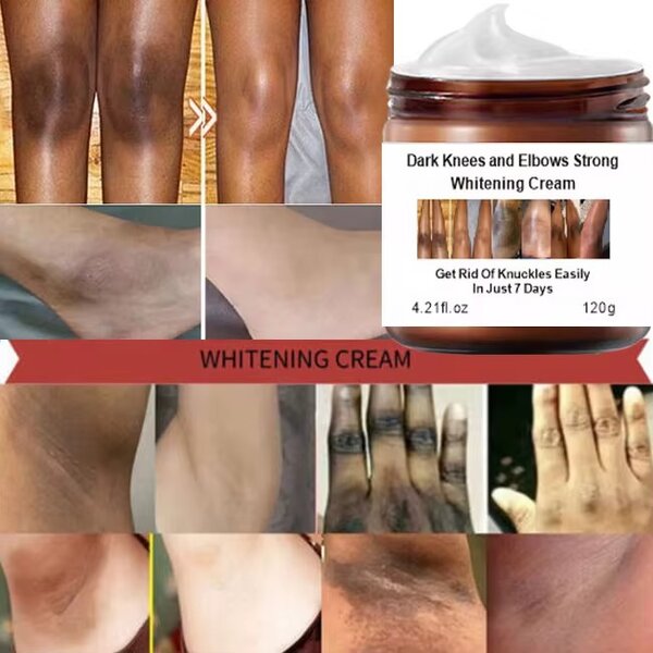 7Days_Mooyam Dark Knees, Elbows & Knuckles whitening Cream