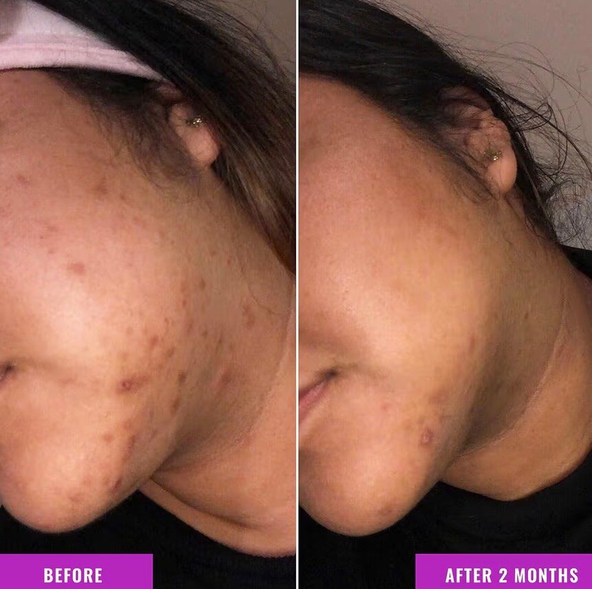 Discoloration Correcting Serum