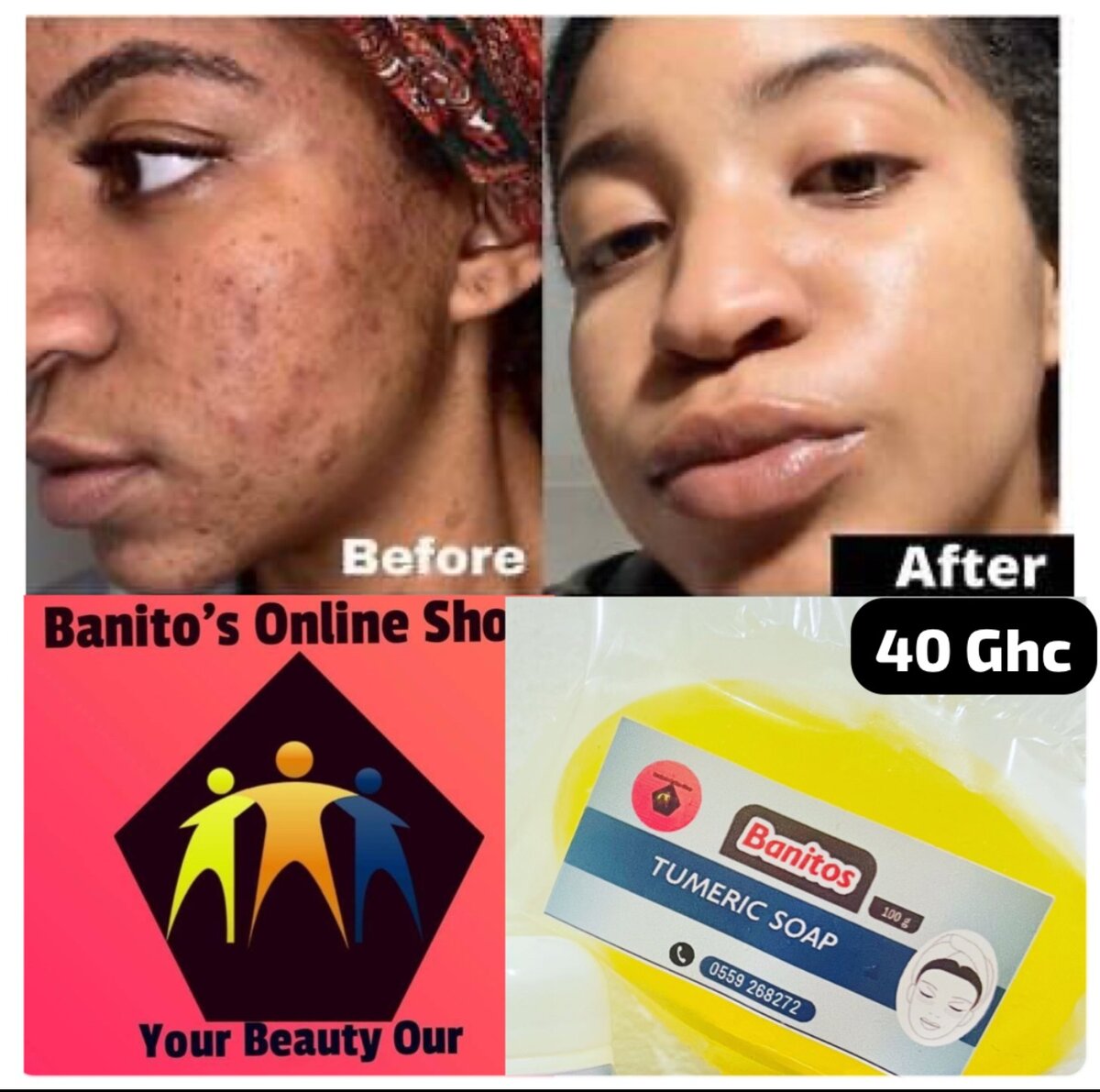 Banitos Tumeric Soap