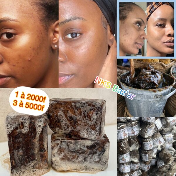 Terminus des boutons et taches !!!