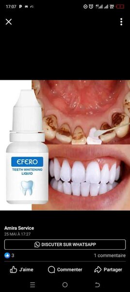 Blanchiment dentaire