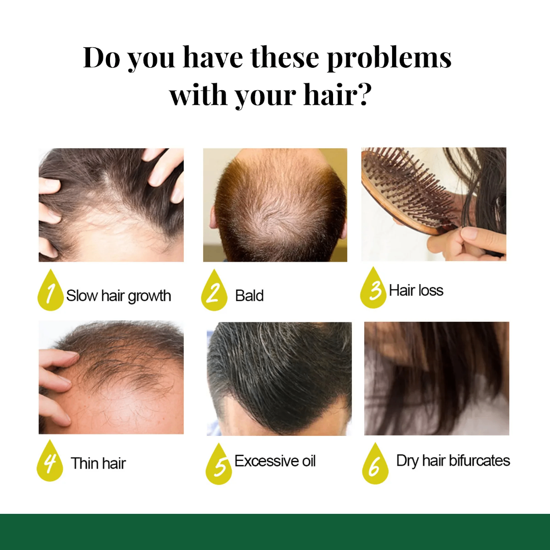 Huile Germinale pour Cheveux