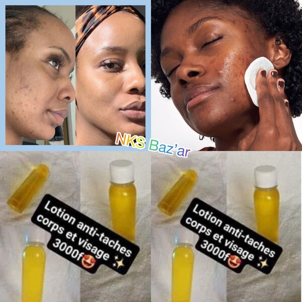 Élimine les peaux mortes, taches, excès de sébum