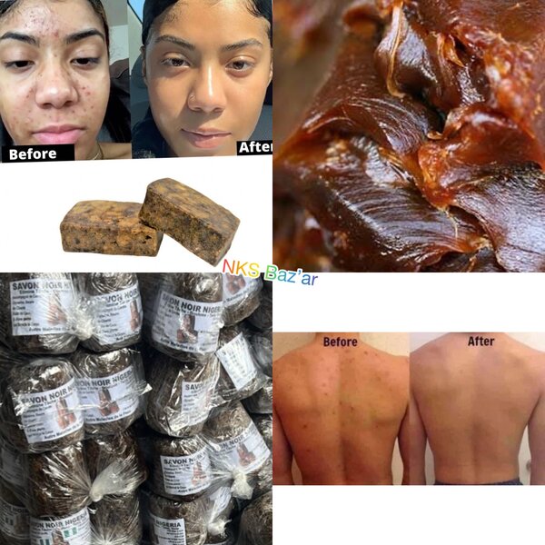 Élimine les gales et taches . Sèche les boutons