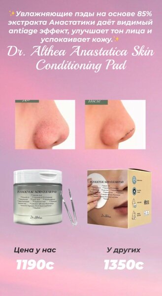 Отшелушивающие пэды от черных точек и для сужения пор