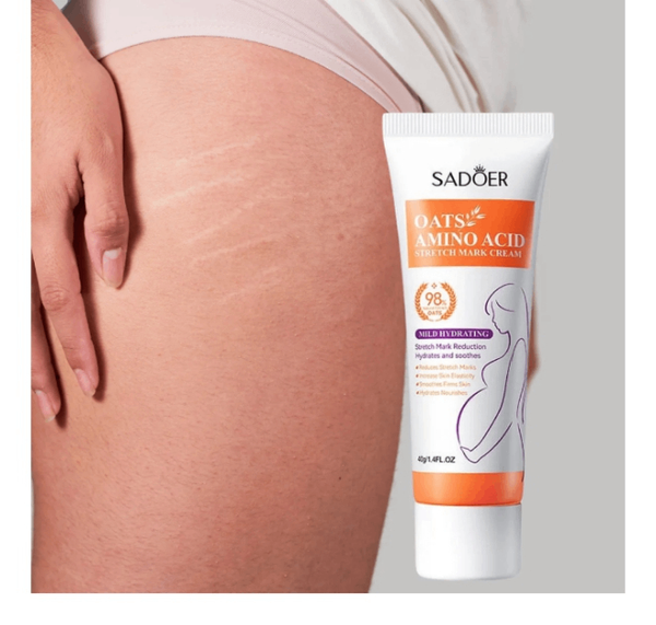 Crème Anti-Vergetures SADOER