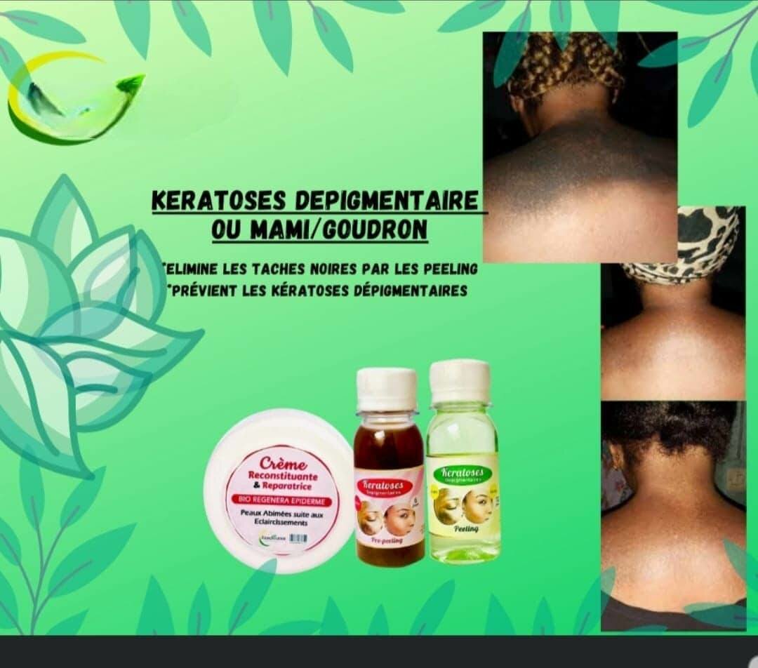 Lotion peeling tâches noires quinto 