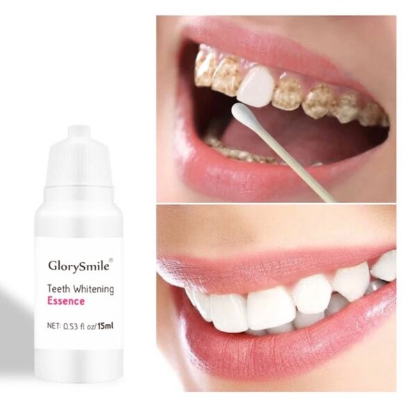 GlorySmile Essence Blancheur Dents