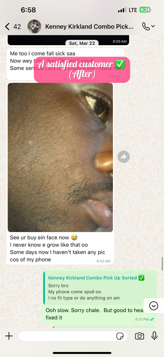 For Beard growth & Baldness