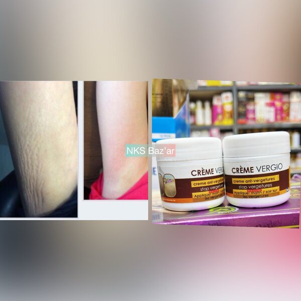 Secret pr atténuer, éliminer progressivement les vergetures