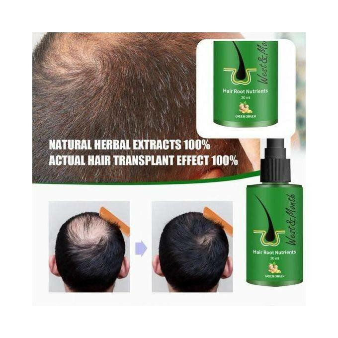 Sérum Capillaire Dexe 120ml