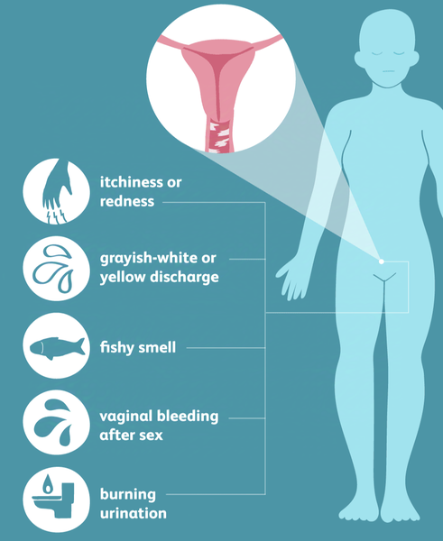 Boric Acid Suppository