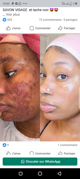 Savon visage anti-imperfections