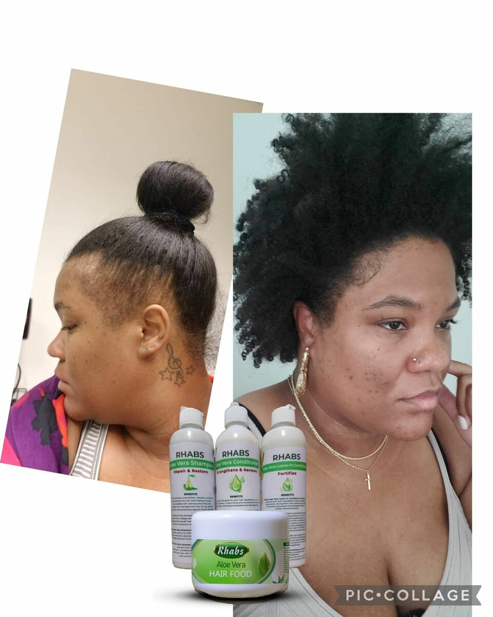 Rhabs Aloe Vera Hair Growth & Treatment Set