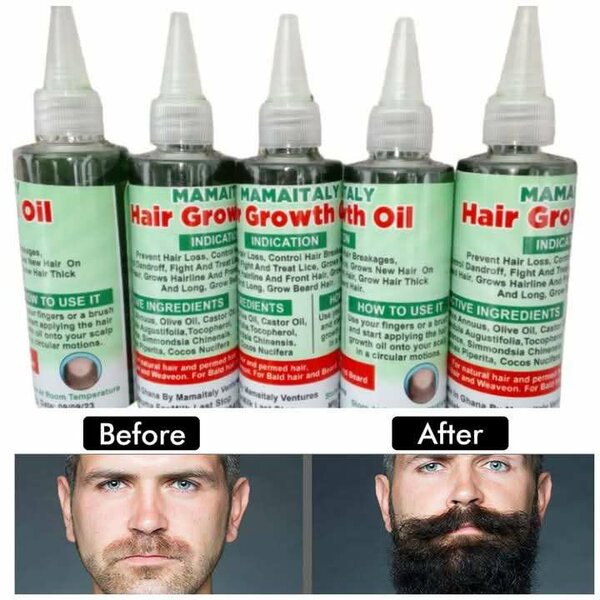 MAMAITALY HAIR GROWTH OIL