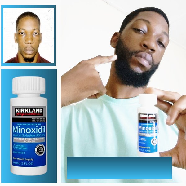 Minoxidil Kirkland 5% Pousse Barbe