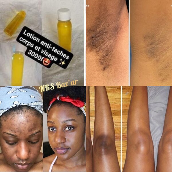 J´offre 1 à 2500f au lieu de 3000f aux10 premières commandes