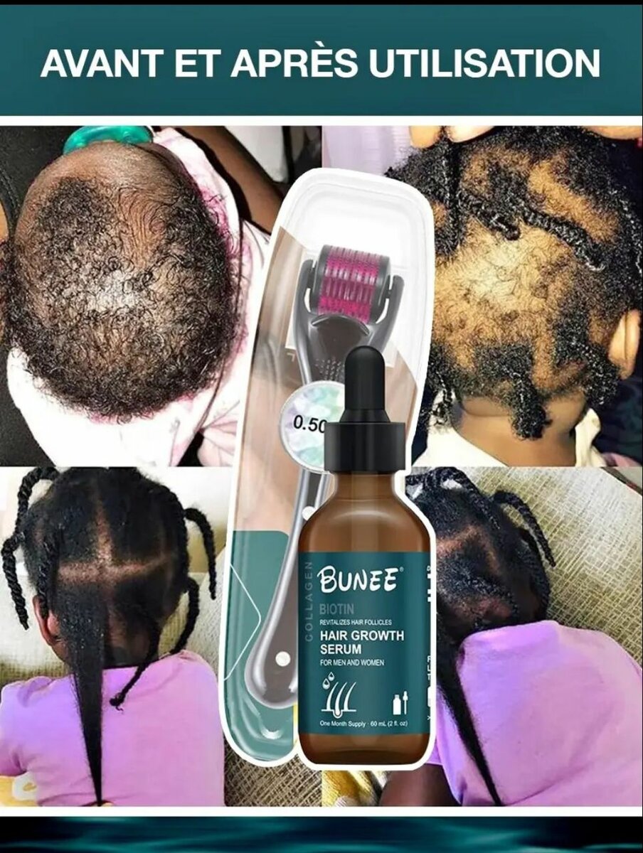 Bunée Serum de Croissance des Cheveux