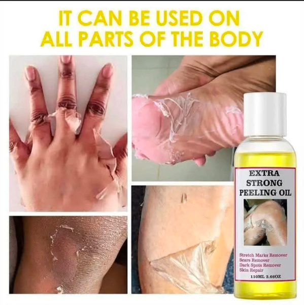 Extra strong peeling oil