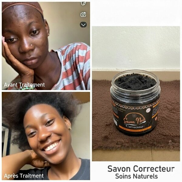 Savon Correcteur Visage
