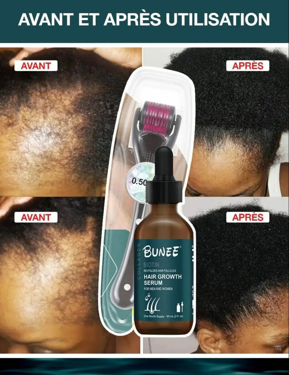 Bunée Serum de Croissance des Cheveux
