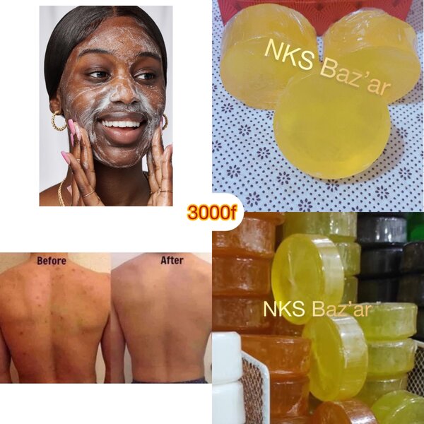 Adoucit, nourit et élimine les taches et boutons