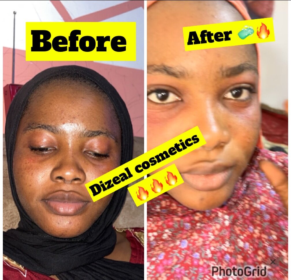 Dizeal cosmetics ️