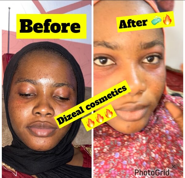 Dizeal cosmetics ️