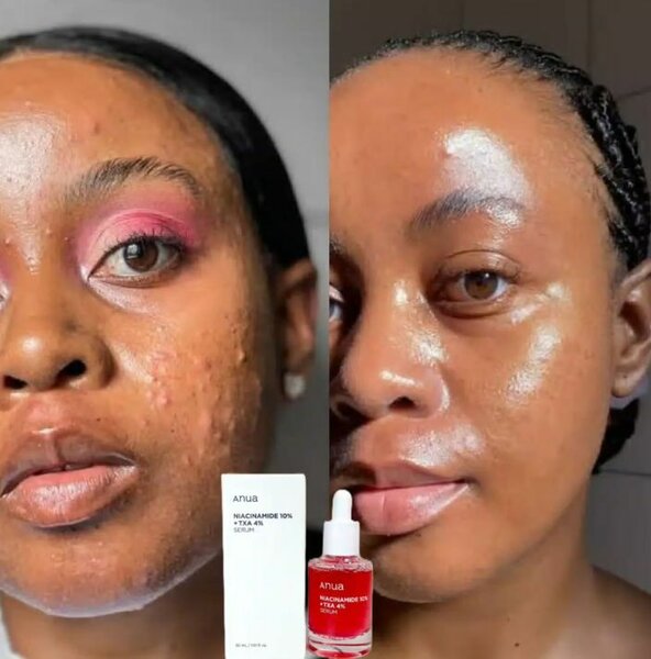 Sérum Correcteur Taches Anua