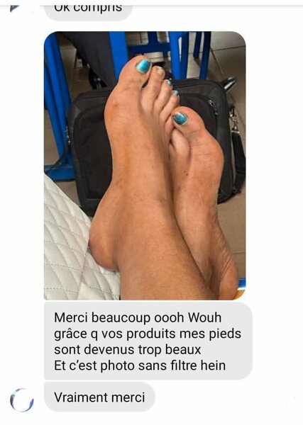 Kit tâches noires quinto