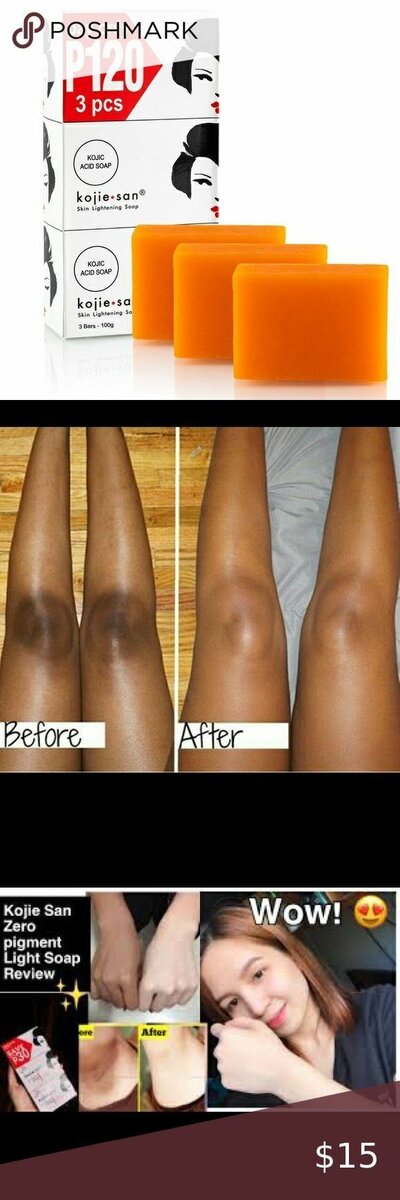 Kojie san soap