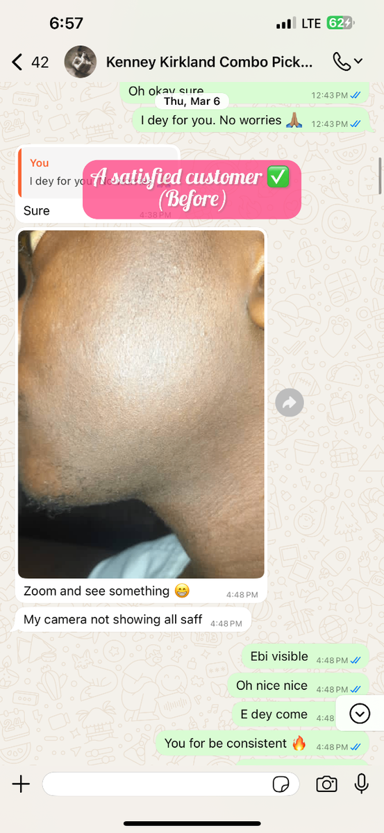 For Beard growth & Baldness