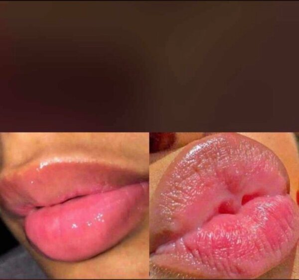 Baume à lèvres rosissante