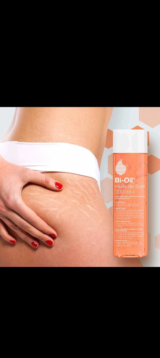 Huile pour vergetures