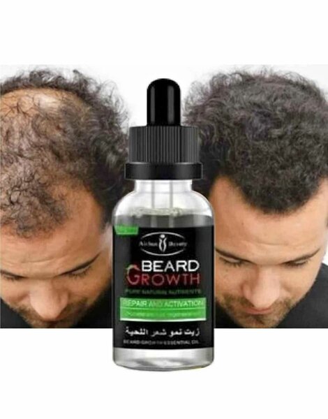 Traitement de calvitie