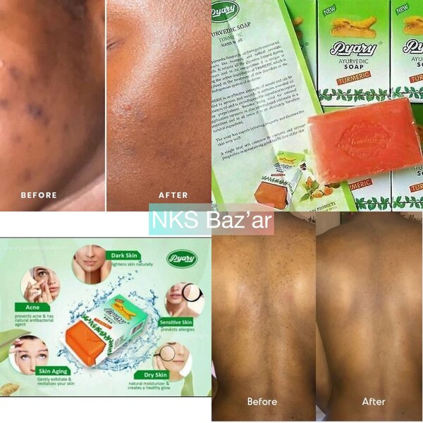 Fini  les boutons, lexcès de sébum, taches et peaux mortes