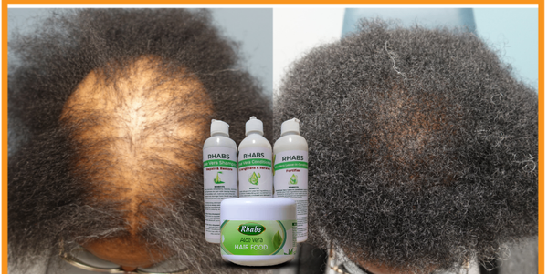 Rhabs Aloe Vera Hair Growth & Treatment Set