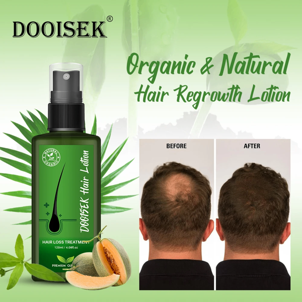 Dooisek Lotion Repousse Cheveux