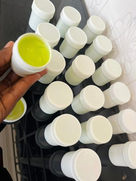 Stretch marks ( vergetures )