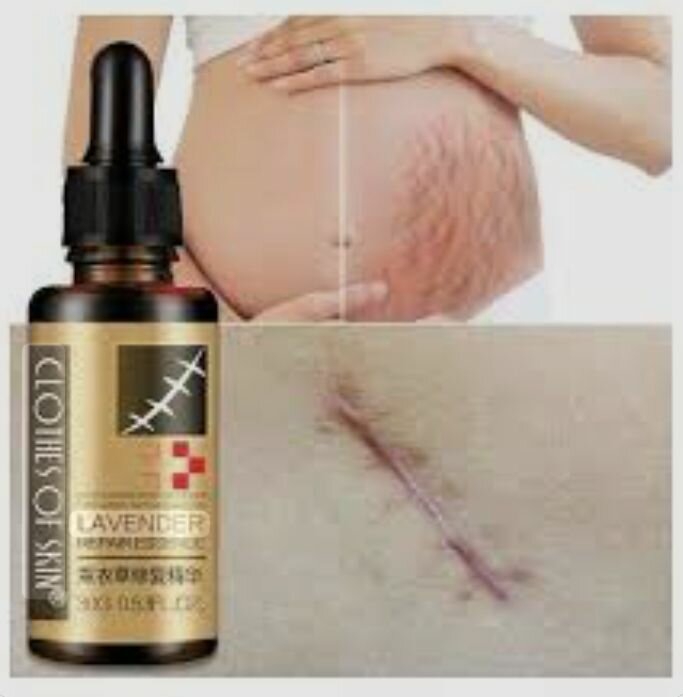 Essence réparatrice lavande cicatrices