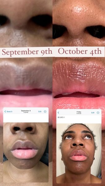 Lèvre rose hydratant