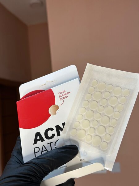 Pimple patches