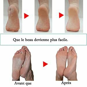 RAPPE ANTI-PEAU MORTE DES PIEDS