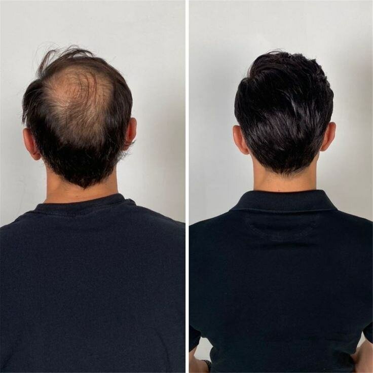 Huile Pousse Barbe Naturelle