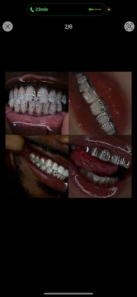 Grillz dentaires en strass