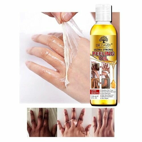 Dr. Davey ultra strong peeling oil