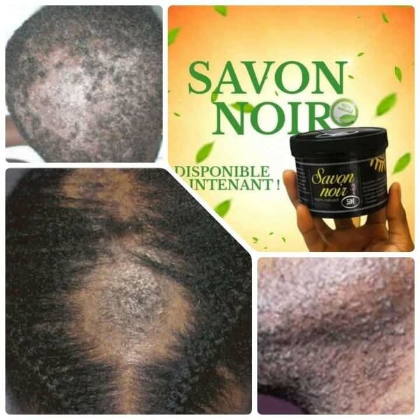 Savon Noir Capillaire Naturel